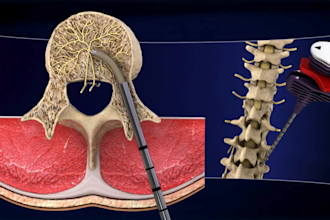 3d medical explainer animated video, 3d surgery animation, dental medical device