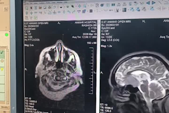 provide ct,mri,cbct radiology reports by expert radiologists