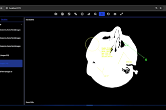 medical imaging viewer development ohif cornerstone expert