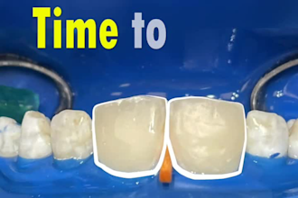 professional dental motion graphics and case presentation videos