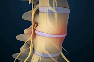 create professional 3d spine surgery orthopedic and medical animation