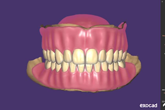 design top notch dental crowns bridges and dentures