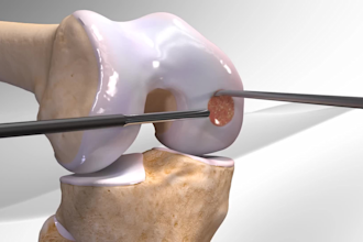 design 3d medical device and surgery animation video