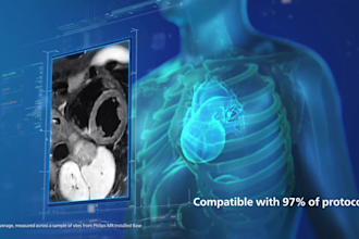 do 3d medical animation 3d medical device animation 3d medical product animation