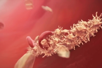 do 3d medical animation neurology healthcare explainer video