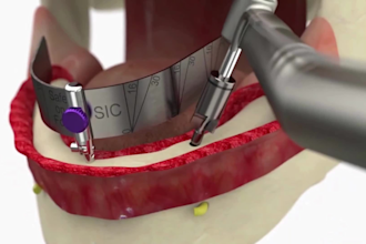 design 3d dental implant prosthesis full arch animation and jaw anatomy model