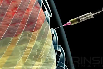 create 3d anatomy animation, orthopedic, surgical procedure, biotech animation