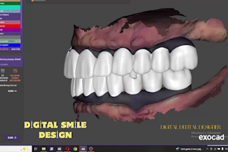 design high precision dental cad crowns bridges and implants using exocad