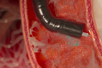 create professional 3d medical and surgical animation video