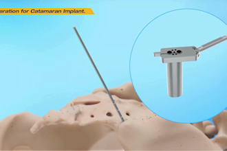 create realistic 3d orthopedic implant animation and surgery visualization