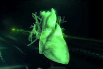 create 3d medical animation mechanism of action and medical device ads animation