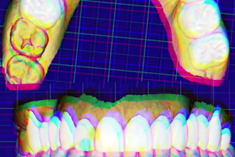 do professional dental cad design using exocad