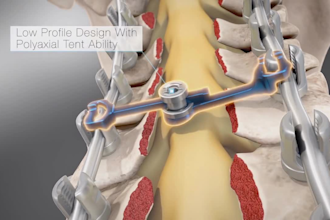 create realistic 3d surgery animation
