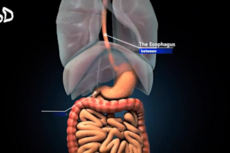 do 3d medical surgery animation anatomy human body health product video