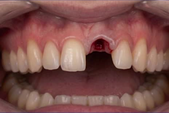 create professional dental animations and 3d dental motion graphics