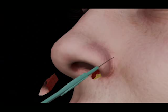 2d and 3d surgery animation