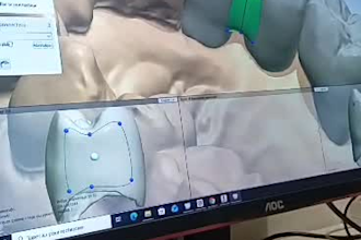 design dental crowns and bridges using 3shape dental system