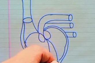 create nursing notes and medical case study