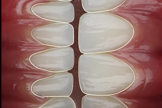 create professional dental motion graphics animation