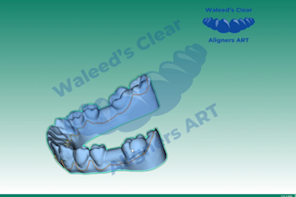 convert your normal intraoral or lab scan directly into a 3d printed aligner