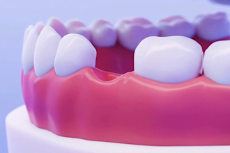 create 3d medical animation dental implant and oral surgery explainer video