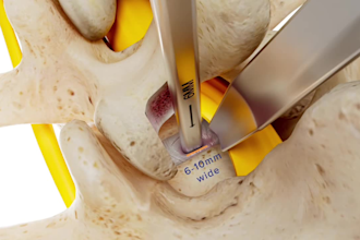 create 3d medical animation video healthcare surgery pharma scientific animation