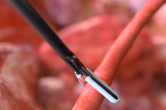 create 3d medical animation medical device surgical product anatomy explainer