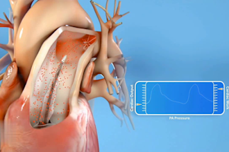 do 3d medical animation video for healthcare anatomy dental surgical procedures
