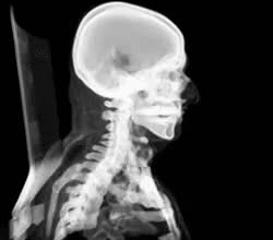 process your radiology study according to your specifications