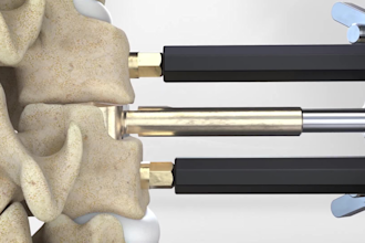create 3d surgical procedure animation for medical education