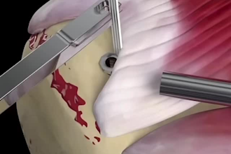 write high quality medical articles and healthcare content