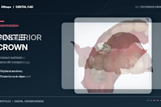 design anterior and posterior dental crowns using 3shape