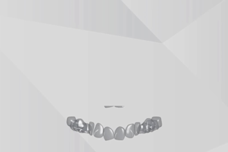 do 3d orthodontic animation, dental animation and teeth straightening video
