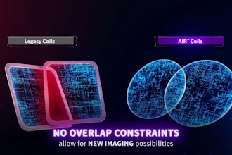 do cgi quality 3d medical animation video and 3d model 3d surgery animation
