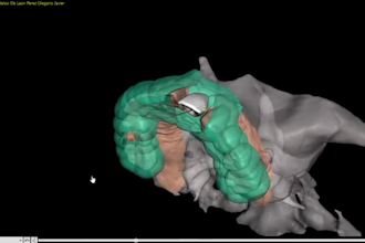 design your dental implant surgical guide as a real dentist