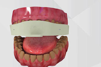create 3d medical animation anatomy dental implant oral surgery animation video
