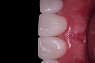 create 3d dental animation and medical motion graphics