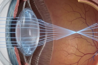 create 3d ai medical animation, medical education, patient education, anatomy