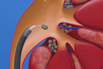 animate your surgical procedure , medical device in 3d