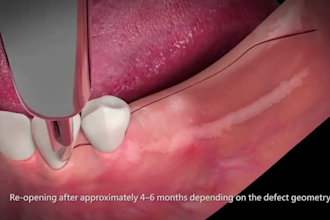 create scientifically accurate 3d medical animation, 3d dental animation