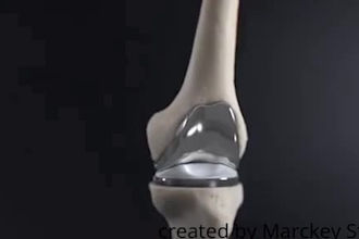 create realistic 3d medical, dental and orthopedic surgery animation video