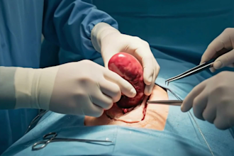 create ai 3d medical animation, surgical animation medical explainer video