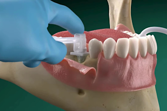 do 3d dental animation 3d dental implant video 3d dental medical explainer video