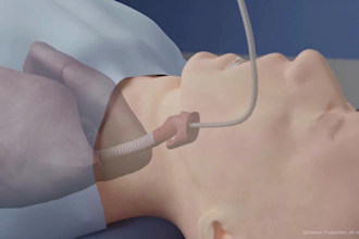create 3d medical animation surgical procedure and anatomy  video