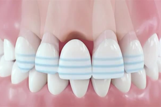 do 3d dental animation oral surgery 3d tooth animation 3d medical animation