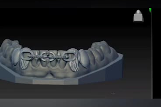 design custom grillz ready for 3d printing