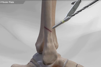create professional 3d surgical and orthopedic medical animations