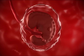 do 3d medical procedure video health product human body surgery animation