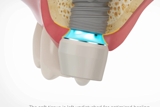 create 3d dental implant animation and surgical medical animation