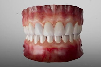 create 3d medical animation video for surgery procedures